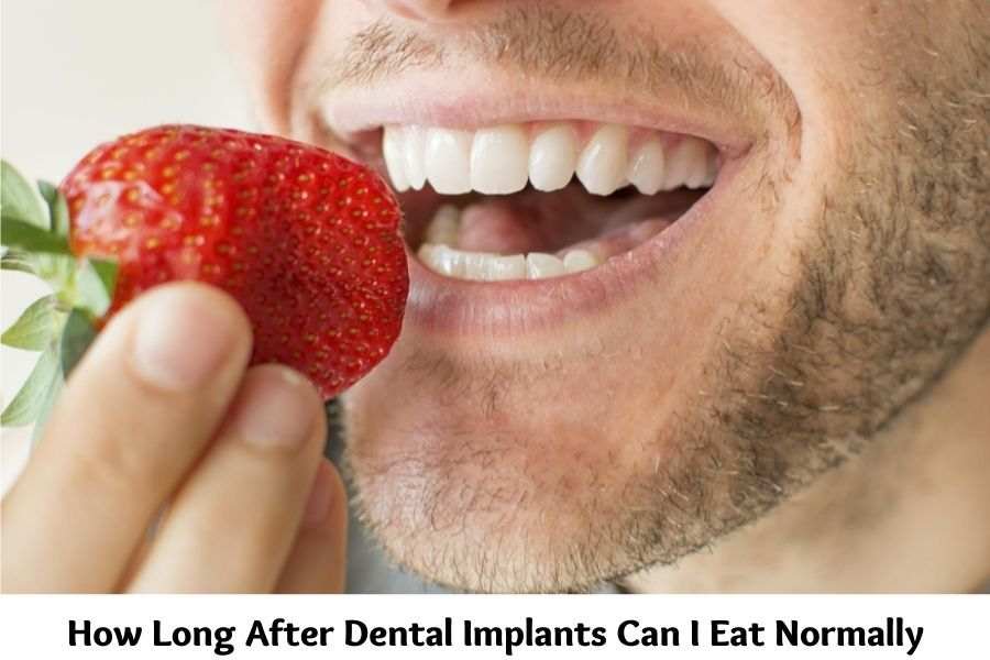 How many days after dental implants can I eat normally