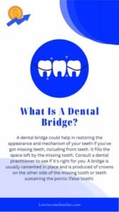 How much does a typical dental bridge cost